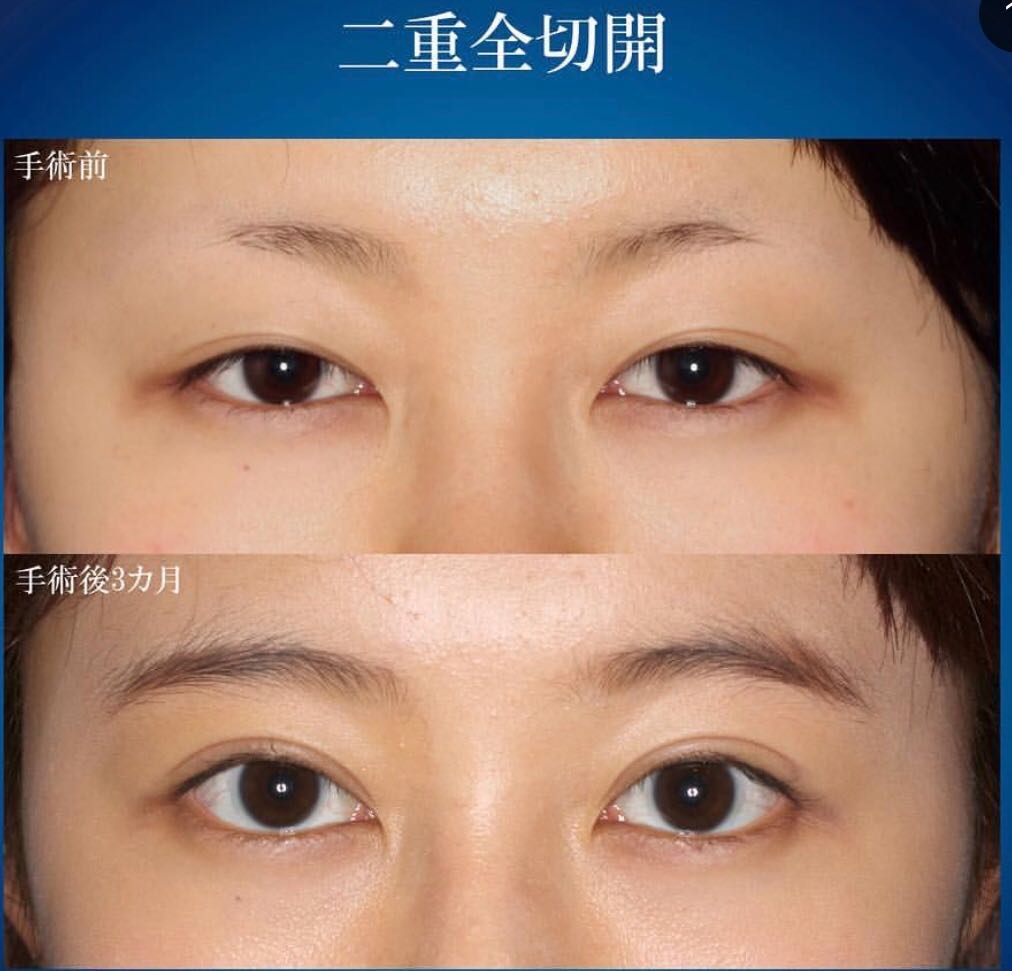 iOS の画像 (4).jpg