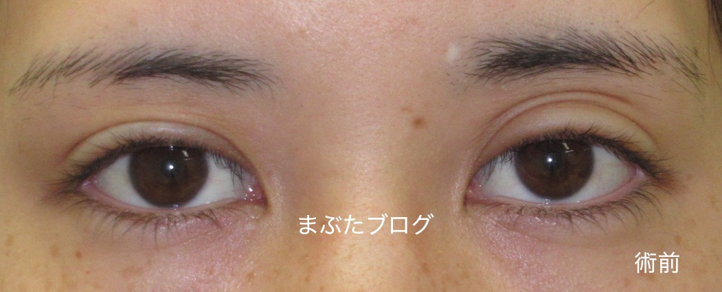 20190608173542.jpg