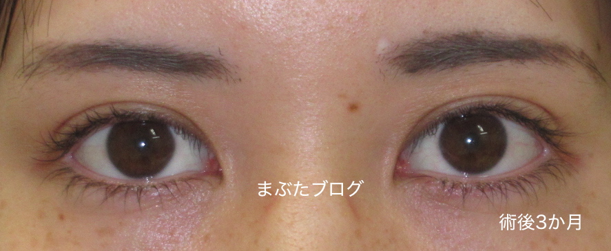 20190615140141.jpg
