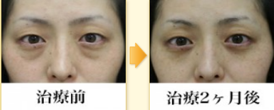 症例１.PNG